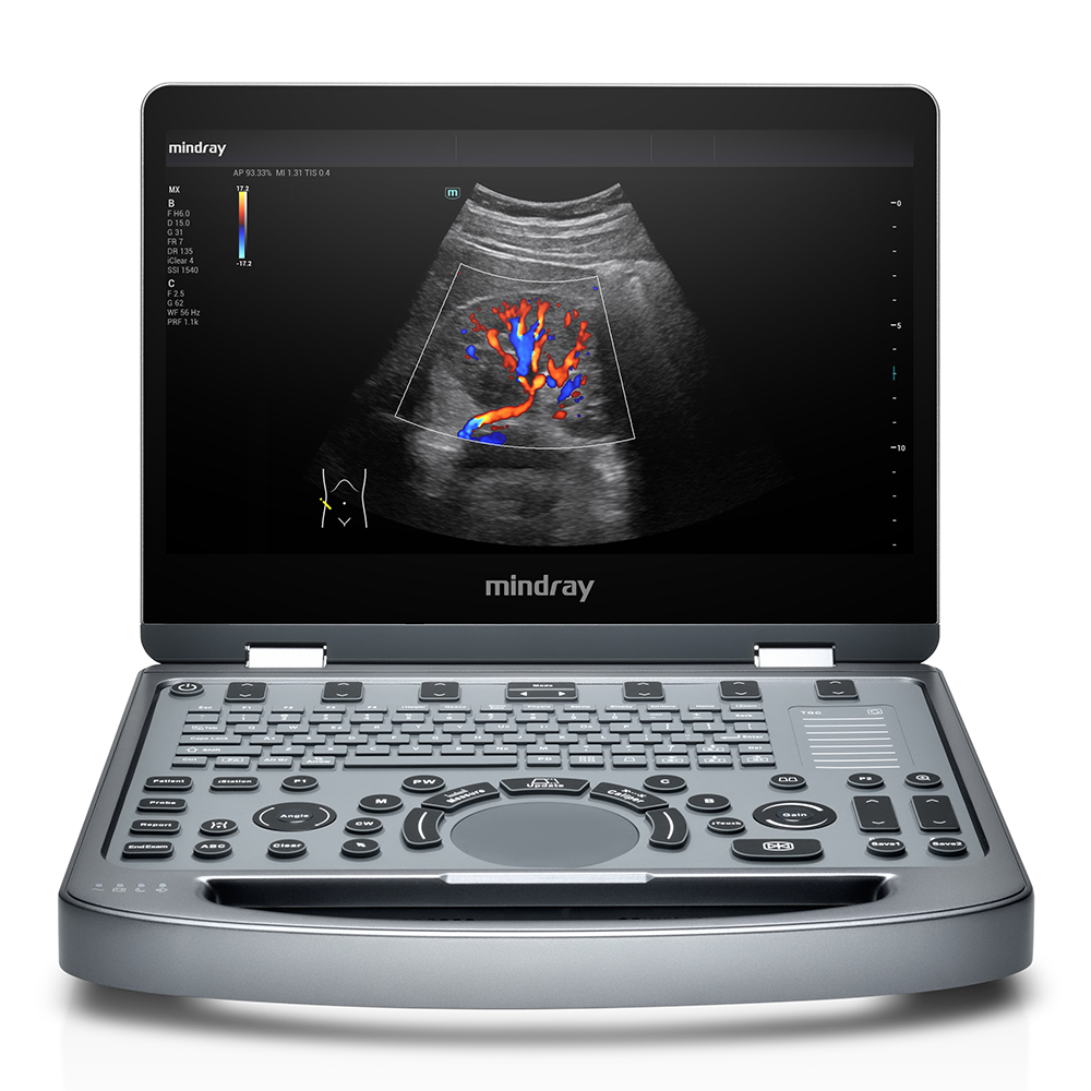 Ultrassom MX3