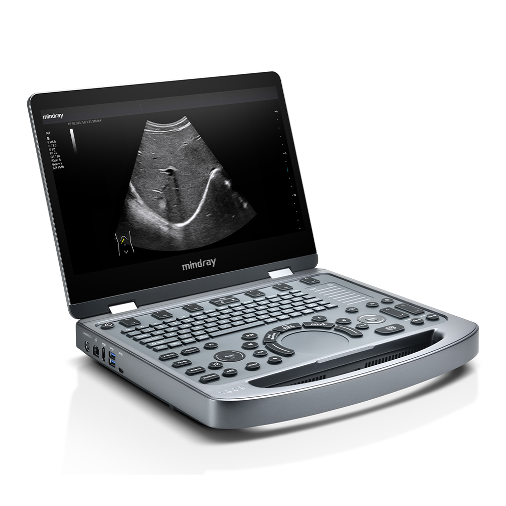 Ultrassom MX6