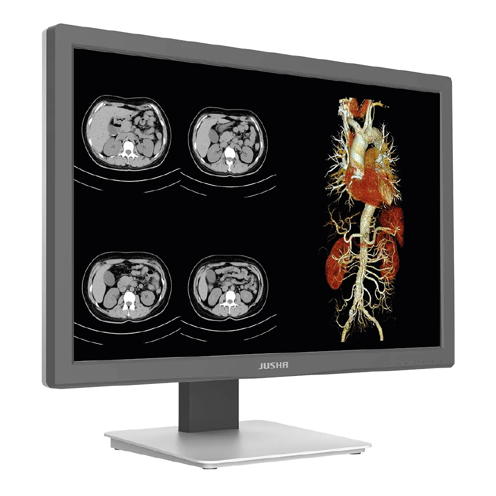 Monitor Colorido CR240G