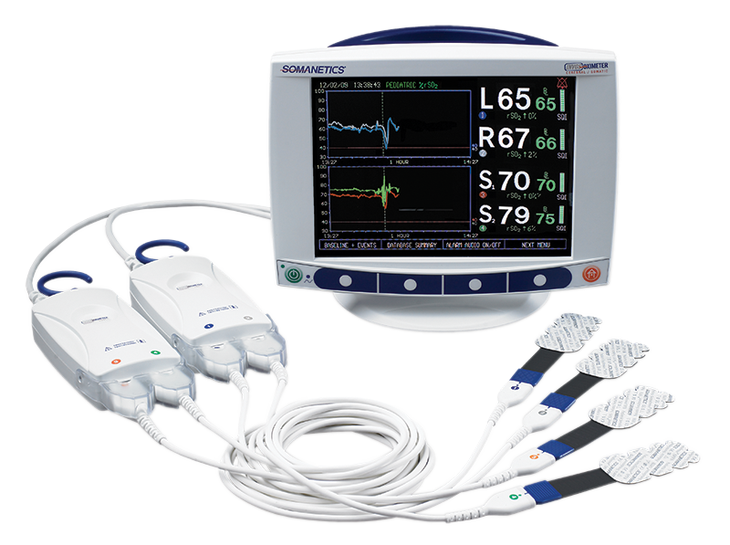 INVOS™ – Monitor da perfusão cerebral