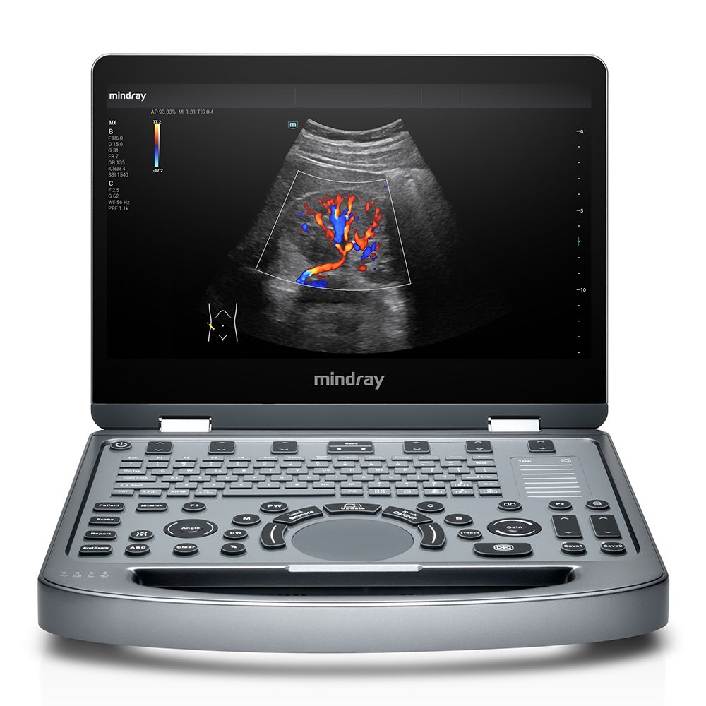 Ultrassom MX3