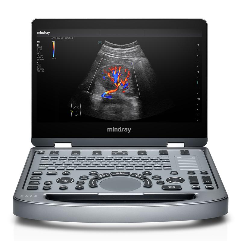 Ultrassom MX3