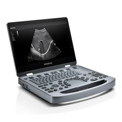 Ultrassom MX6