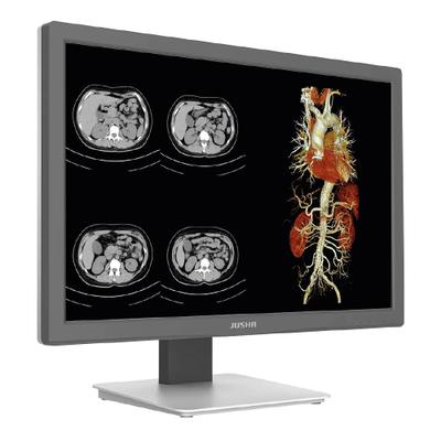 Monitor Colorido CR240G